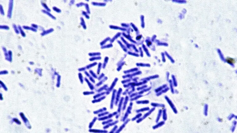 astronotlar icin umut veren kesif mikroorganizmalarin uzay direnci kanitlandi uArPwBmI.jpg