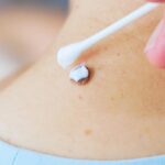 lazer de yaptiran da var solusyon suren de her ben masum degil incelenmeli C37cdR2r.jpg