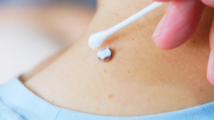 lazer de yaptiran da var solusyon suren de her ben masum degil incelenmeli C37cdR2r.jpg