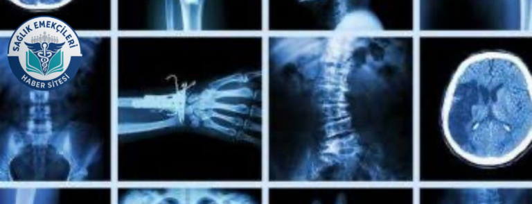 radyoloji-skandali-iddiasi-savcilik-harekete-gecti-yanlis-raporlar-mercek-altinda-saglik-emekcileri-haber-kanali-u8B4LYQD.png