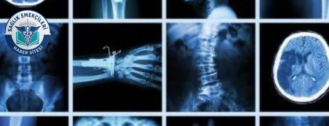 radyoloji-skandali-iddiasi-savcilik-harekete-gecti-yanlis-raporlar-mercek-altinda-saglik-emekcileri-haber-kanali-u8B4LYQD.png